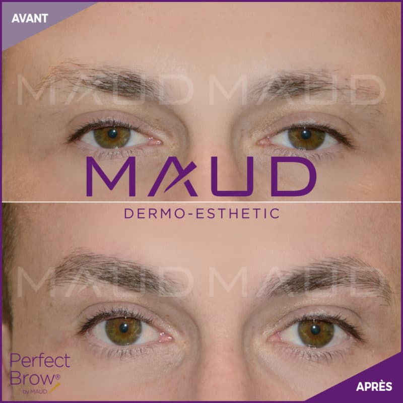 Maquillage Permanent Masculin Avant Apr S Maud Dermo Esthetic