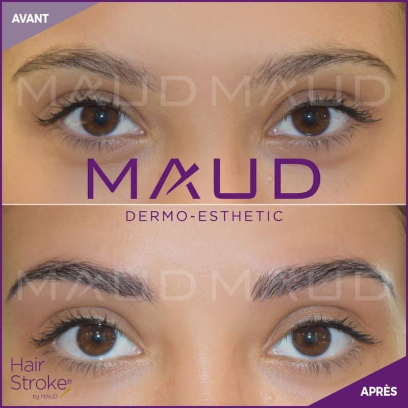 Maquillage Permanent Sourcils Avant Apr S Maud Dermo Esthetic