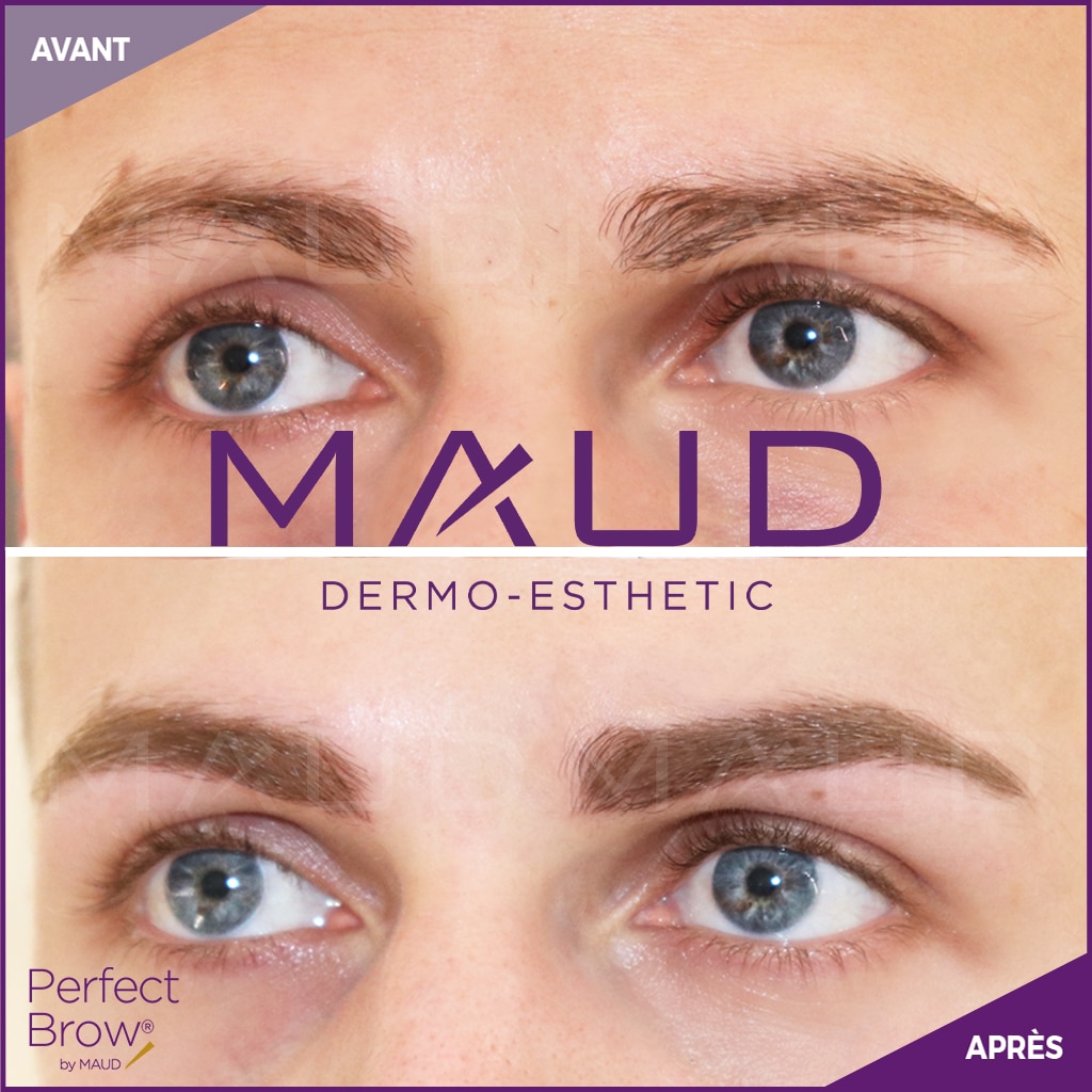 Maquillage Permanent Masculin Avant Apr S Maud Dermo Esthetic