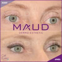 maquillage-permanent-cat-eyes-maud-dermo-esthetic.01