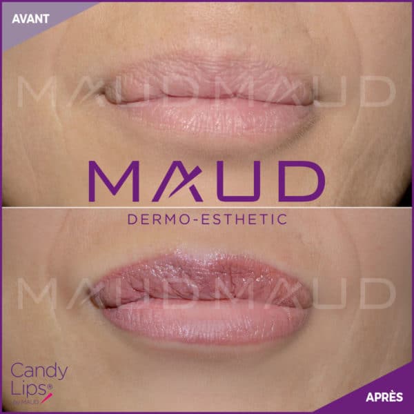 Candy Lips Avant Après Maquillage Permanent Sourcils MAUD