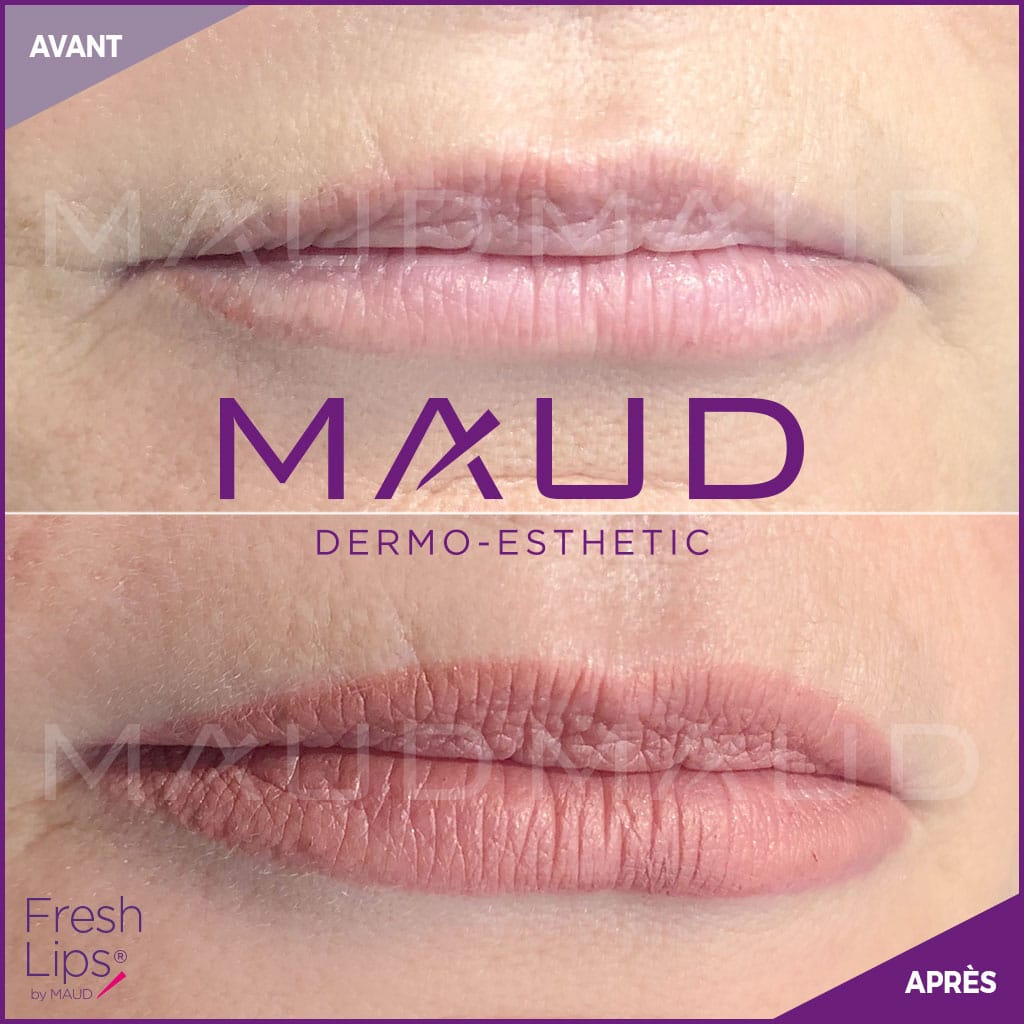 maquillage-permanent-levres-fresh-lips-maud-dermo-esthetic-3