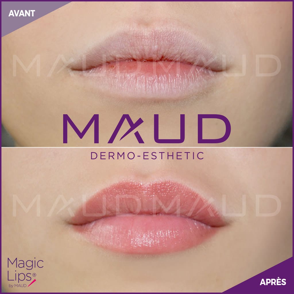 maquillage-permanent-levres-magiclips-maud-dermo-esthetic-02