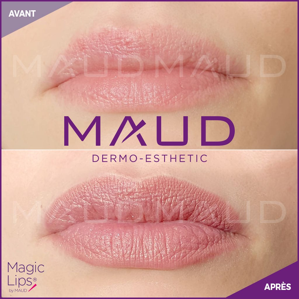 maquillage-permanent-levres-magiclips-maud-dermo-esthetic-04