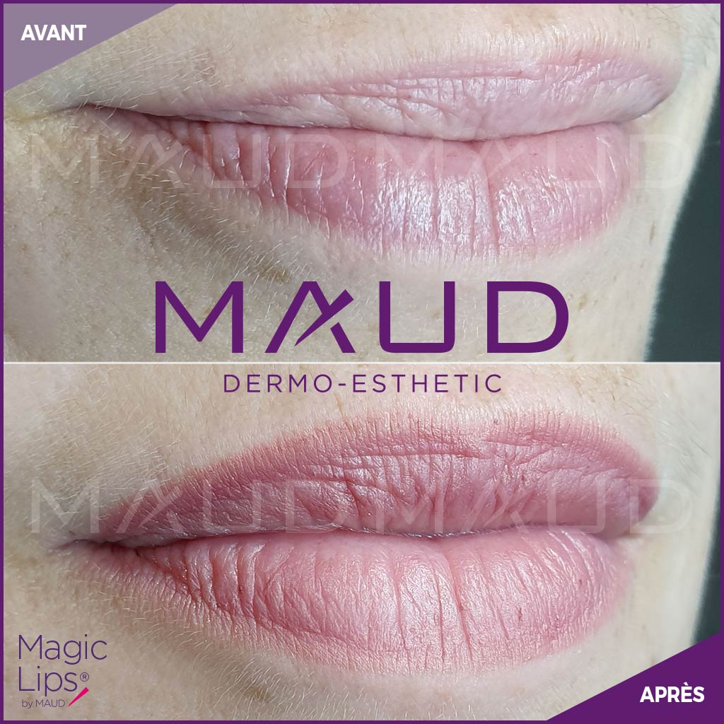 maquillage-permanent-levres-magiclips-maud-dermo-esthetic-06