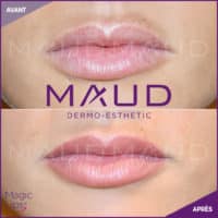 maquillage-permanent-levres-magiclips-maud-dermo-esthetic-09