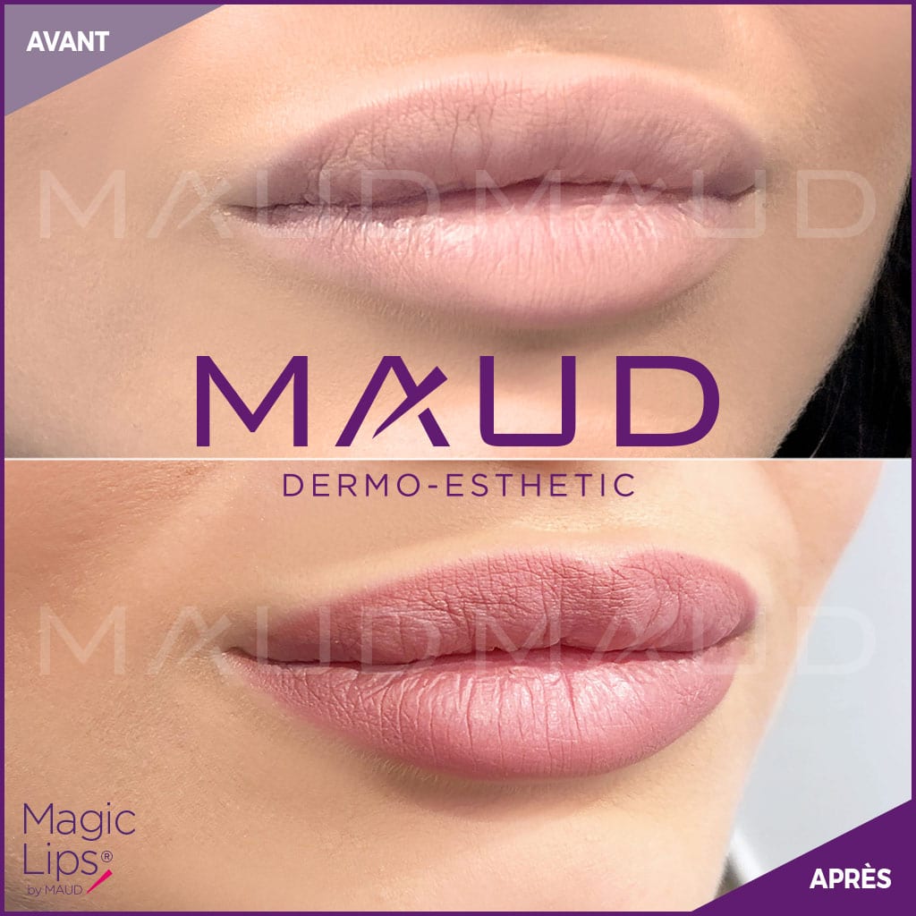 maquillage-permanent-levres-magiclips-maud-dermo-esthetic-11
