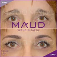 maquillage-permanent-sourcils-brow-lift-maud-dermo-esthetic-02 (1)