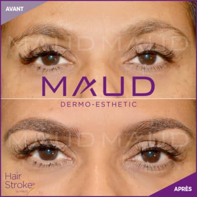 maquillage-permanent-sourcils-hairstroke-maud-dermo-esthetic-02