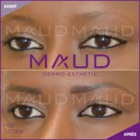 maquillage-permanent-sourcils-hairstroke-maud-dermo-esthetic-05