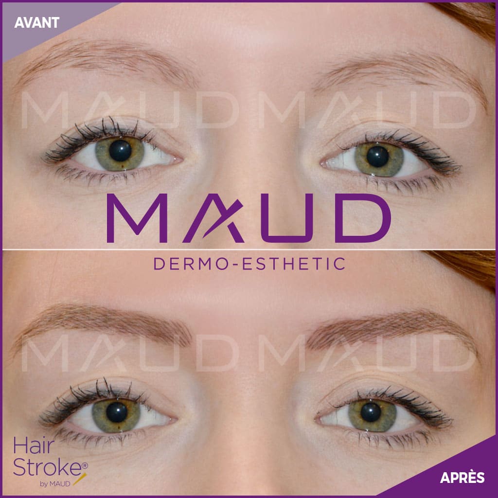 maquillage-permanent-sourcils-hairstroke-maud-dermo-esthetic-06