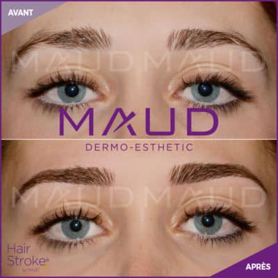 maquillage-permanent-sourcils-hairstroke-maud-dermo-esthetic-08