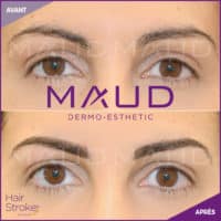 maquillage-permanent-sourcils-hairstroke-maud-dermo-esthetic-11