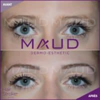 maquillage-permanent-sourcils-hairstroke-maud-dermo-esthetic-13