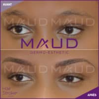 maquillage-permanent-sourcils-hairstroke-maud-dermo-esthetic-14