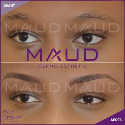 maquillage-permanent-sourcils-hairstroke-maud-dermo-esthetic-14