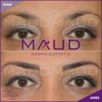 maquillage-permanent-sourcils-hairstroke-maud-dermo-esthetic-15