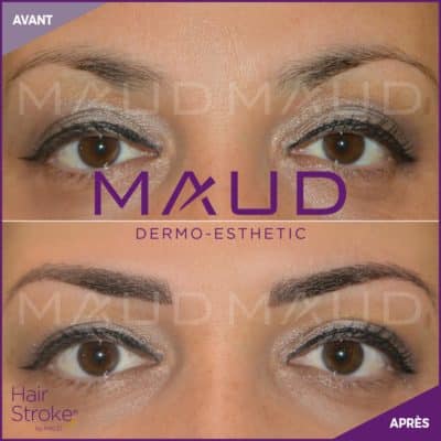 maquillage-permanent-sourcils-hairstroke-maud-dermo-esthetic-15