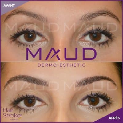 maquillage-permanent-sourcils-hairstroke-maud-dermo-esthetic-16