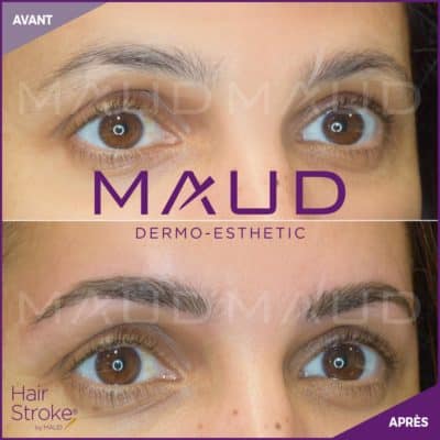 maquillage-permanent-sourcils-hairstroke-maud-dermo-esthetic-17