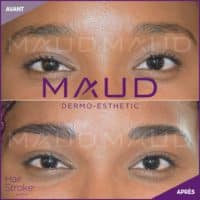 maquillage-permanent-sourcils-hairstroke-maud-dermo-esthetic-20