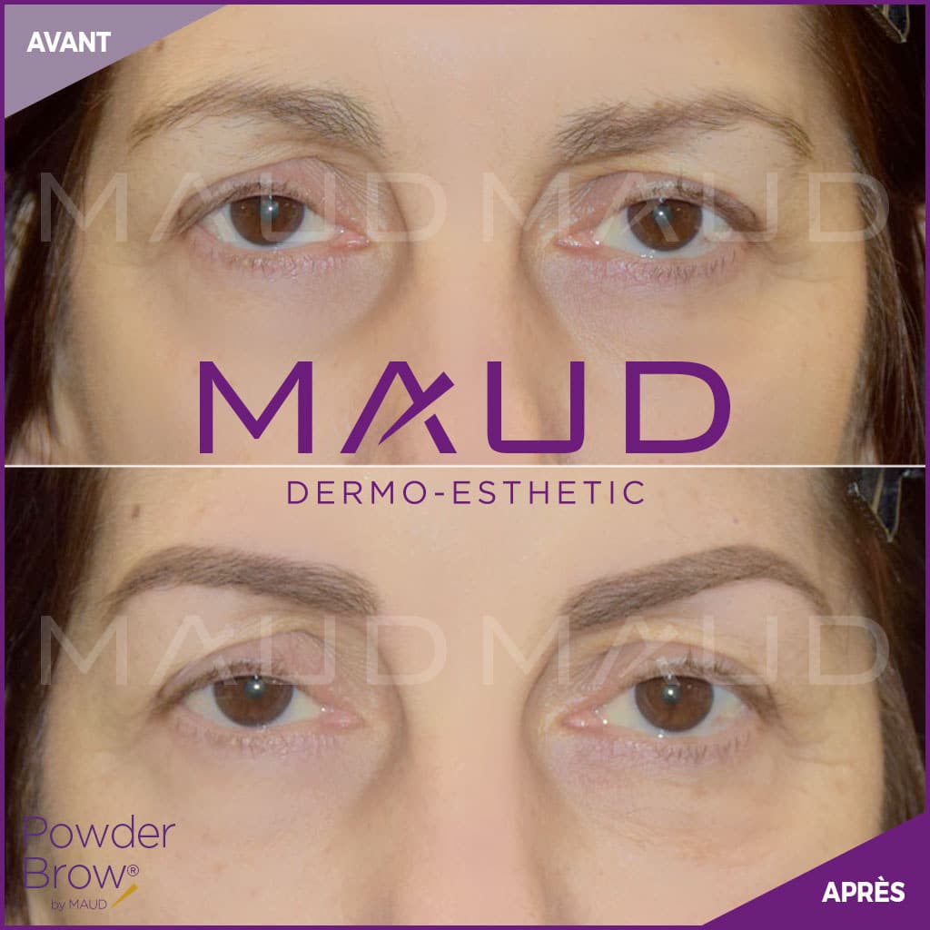 maquillage-permanent-sourcils-powder-brow-maud-dermo-esthetic-10