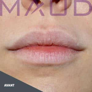 Avant