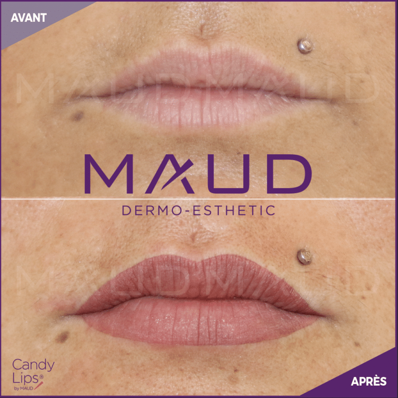 Candy Lips Avant Après Maquillage Permanent Sourcils MAUD