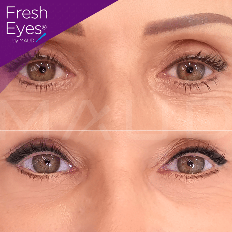 Cat Eyes Avant Après Maquillage Permanent des Yeux Maud